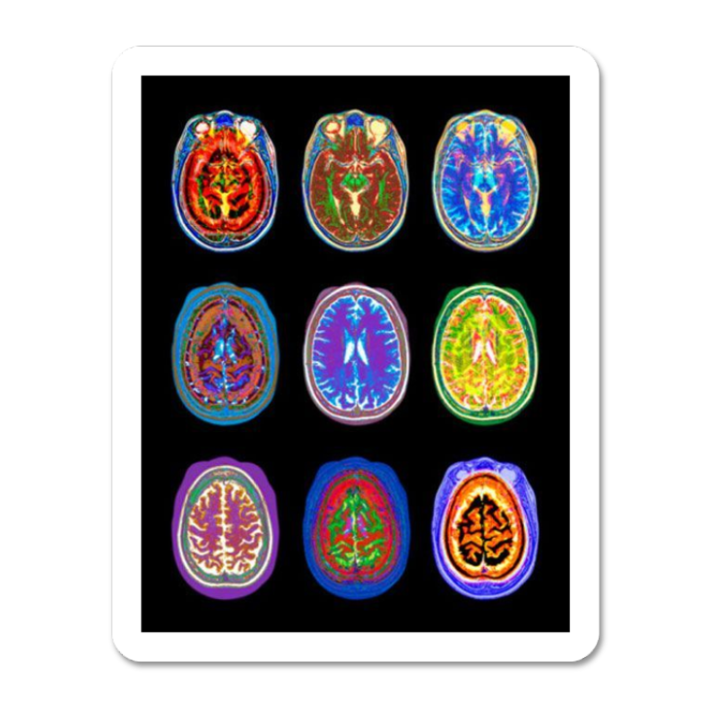 Colorful Brain Scans Sticker waterproof vinyl sticker